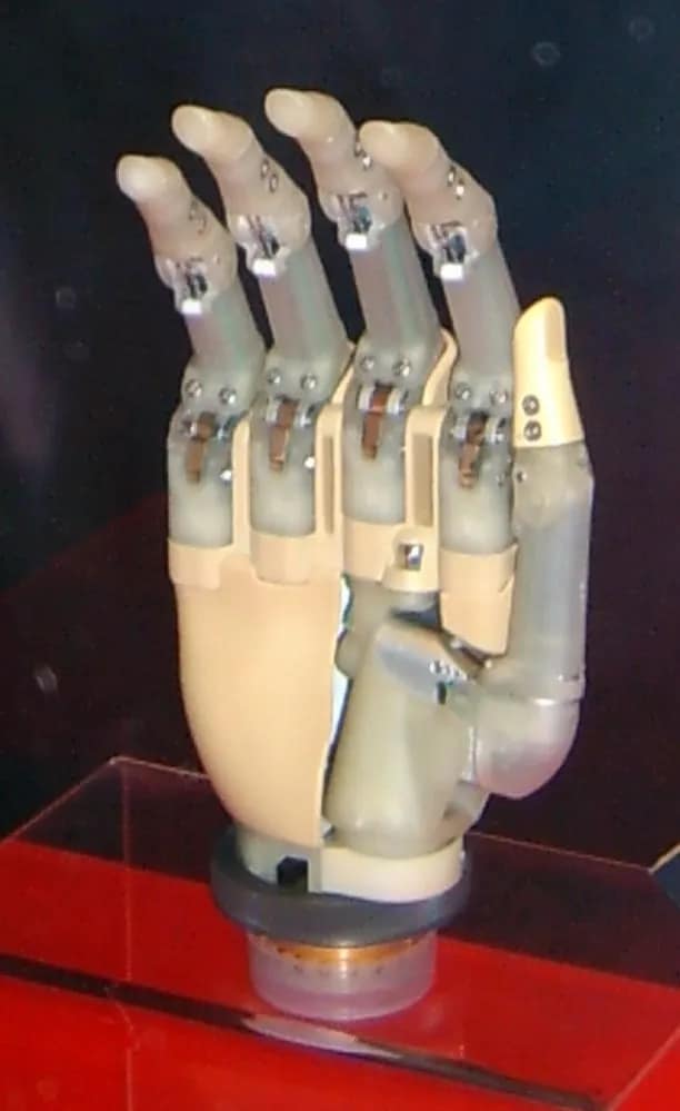 Intelligent Bionic Hand