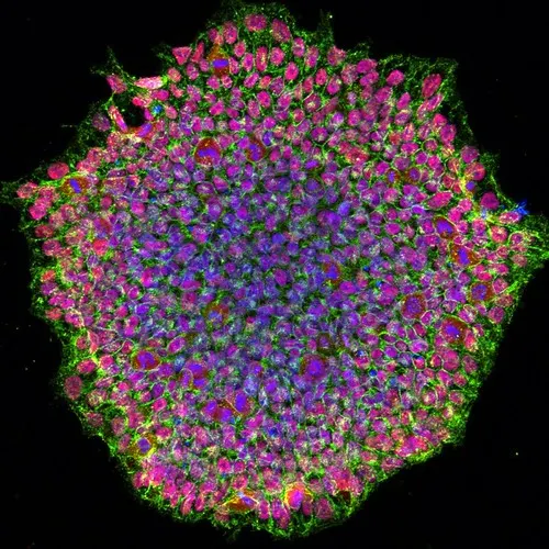 A colony of induced pluripotent stem cells: adult cells fully reprogrammed with Yamanaka factors, which Altos uses only partly to rejuvenate