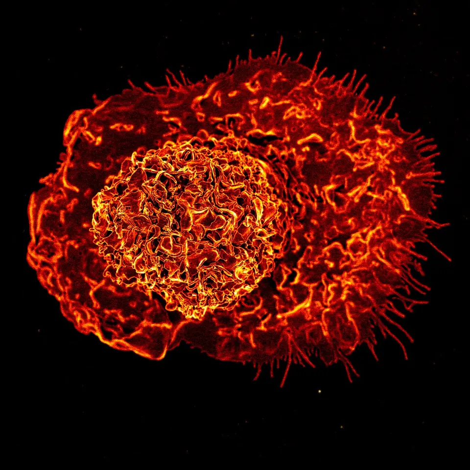 A macrophage, an immune cell where the NLRP3 inflammation switch sits; BGE-102 is meant to block that switch