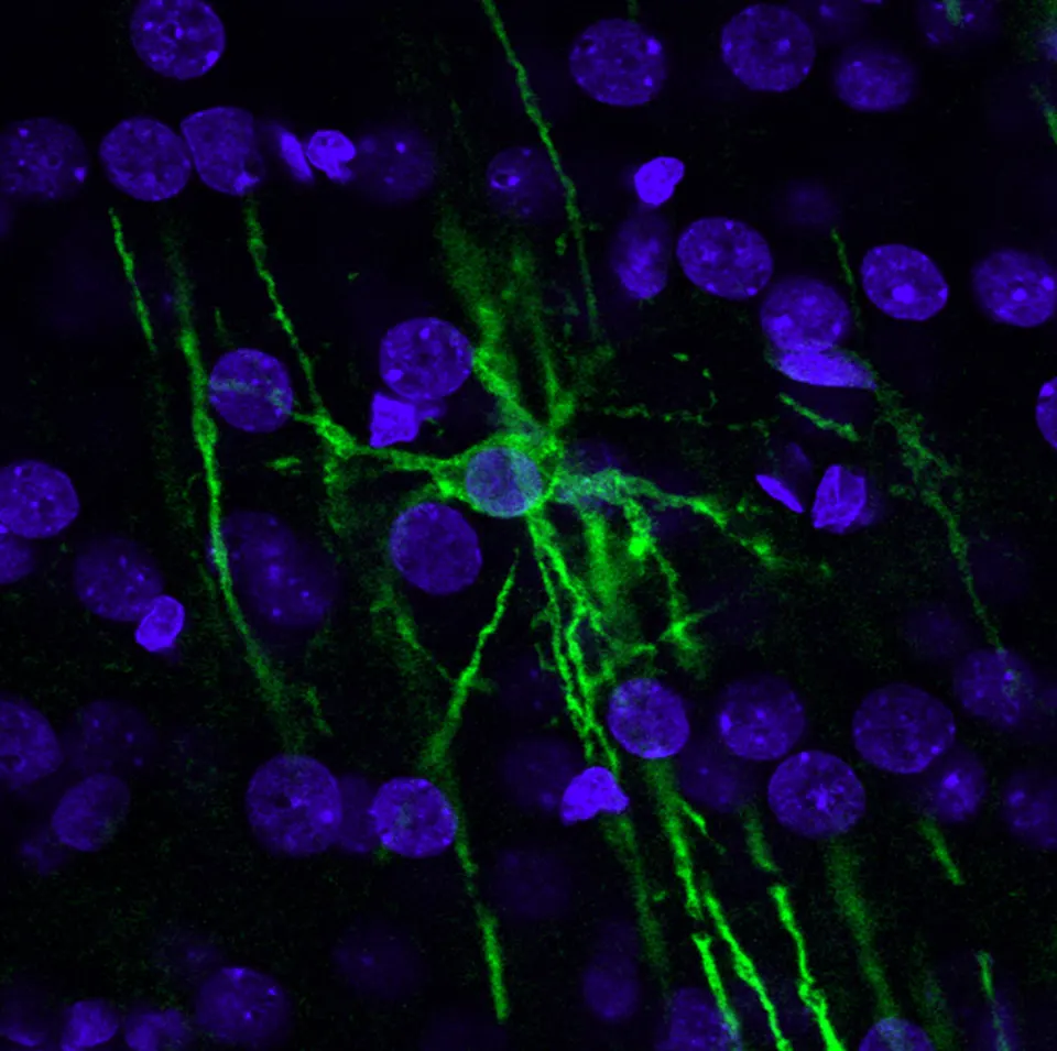 An oligodendrocyte (green), the brain support cell that wraps nerves in myelin and is lost in vanishing white matter disease