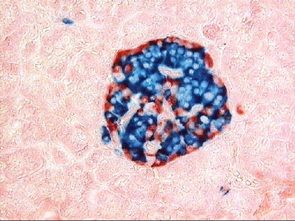 A pancreatic islet: the insulin-making cell cluster that GIP and GLP-1 hormone signals, like tirzepatide's, prompt to release insulin