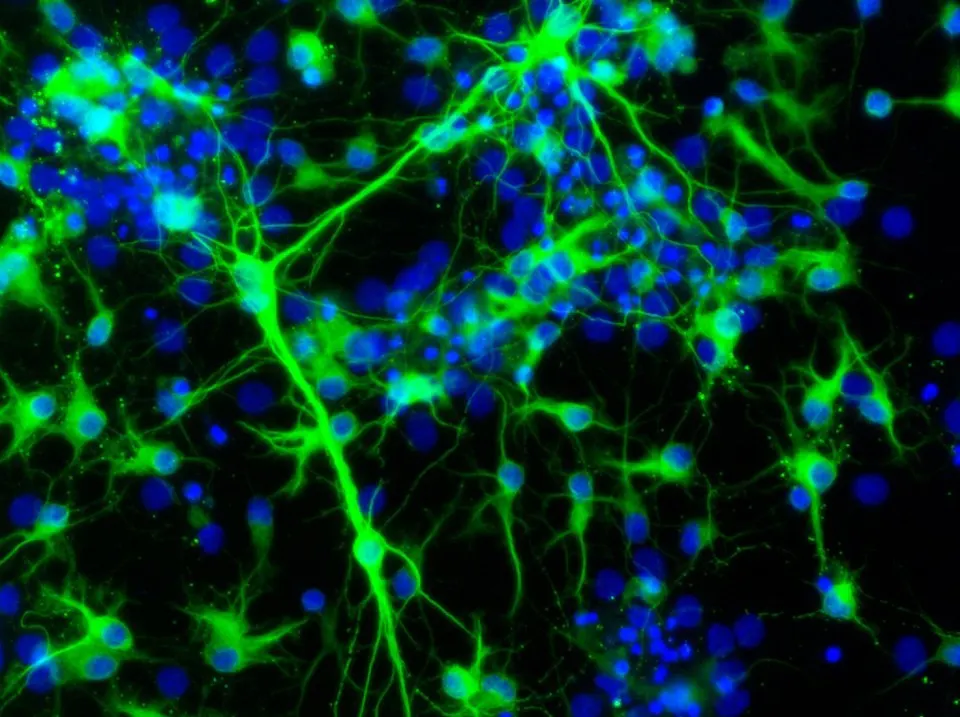 Neurons (green) grown from stem cells in a dish (rat cells): insitro grows patient-derived stem cells into neurons to study disease