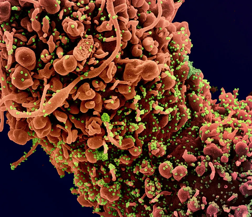 A cell covered in coronavirus particles (green), electron microscope: mRNA vaccines teach cells to show the virus's spike protein