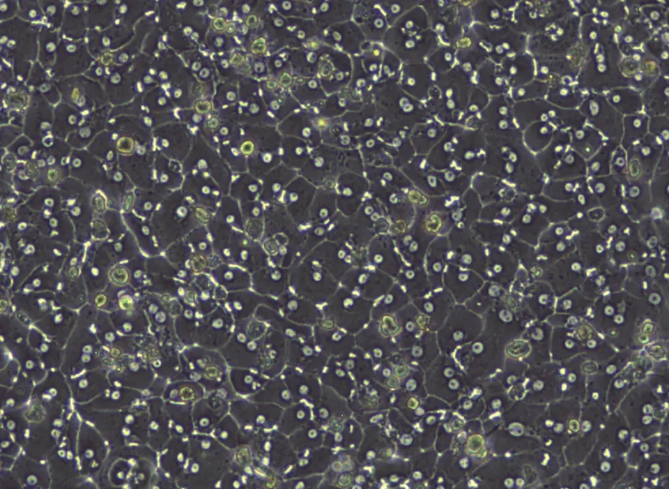 Liver cells (hepatocytes) growing in a dish: the cells NewLimit tries to make work like young ones again