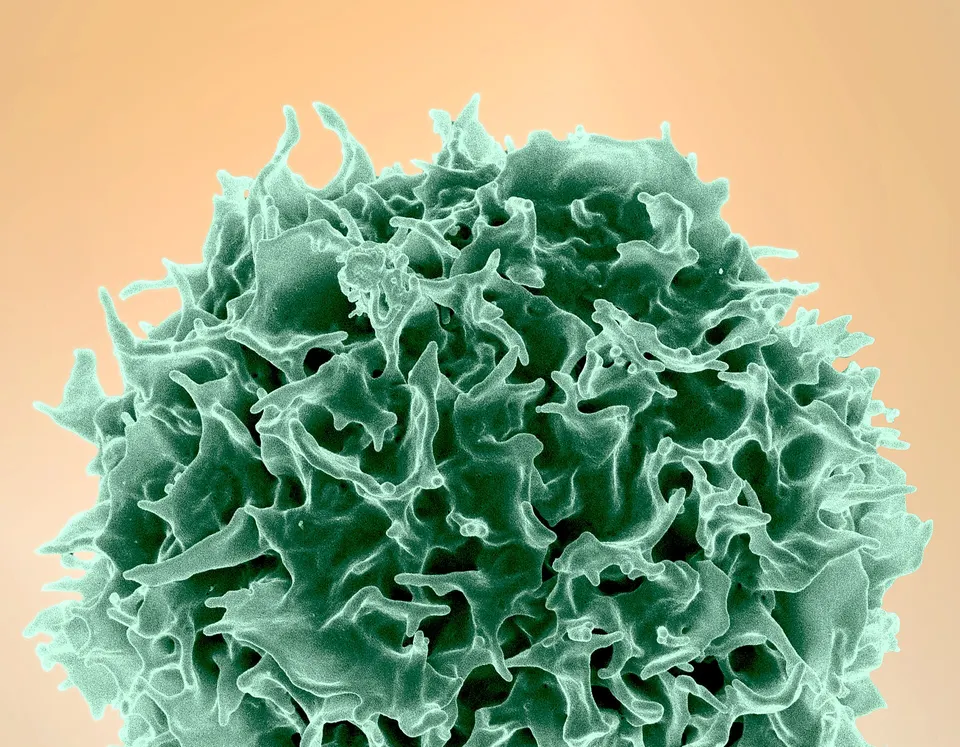 A human T cell under a scanning electron microscope: the kind of immune cell NewLimit tries to make young again