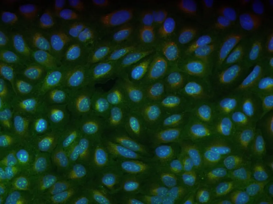Cells stained with Cell Painting dyes (a public dataset): Recursion's robots photograph millions of wells like this for its AI