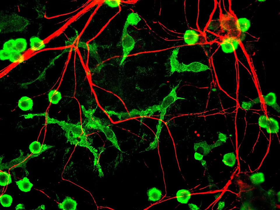 Microglia (green) among nerve fibres (red): the brain's immune cells that Retro wants to replace with young lab-made ones